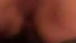 تجميع الشرج عقبة المتجول تلف
